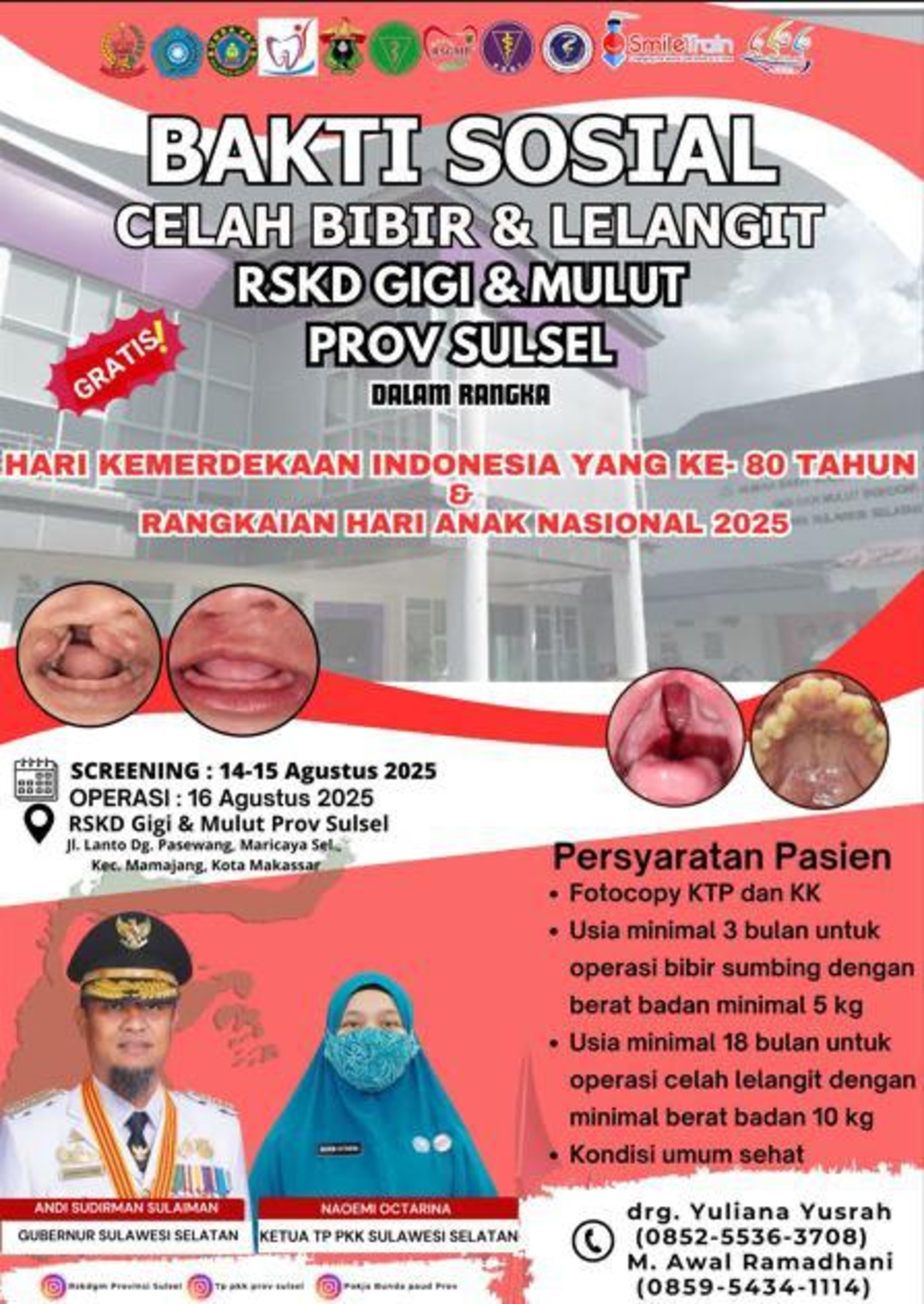 RSKD Gigi dan Mulut Sulsel Gelar Operasi Gratis Celah Bibir dan Lelangit